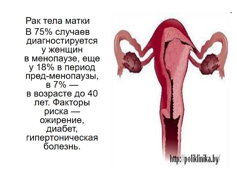 Рак тела матки  В 75% случаев диагностируется у женщин в менопаузе, еще у